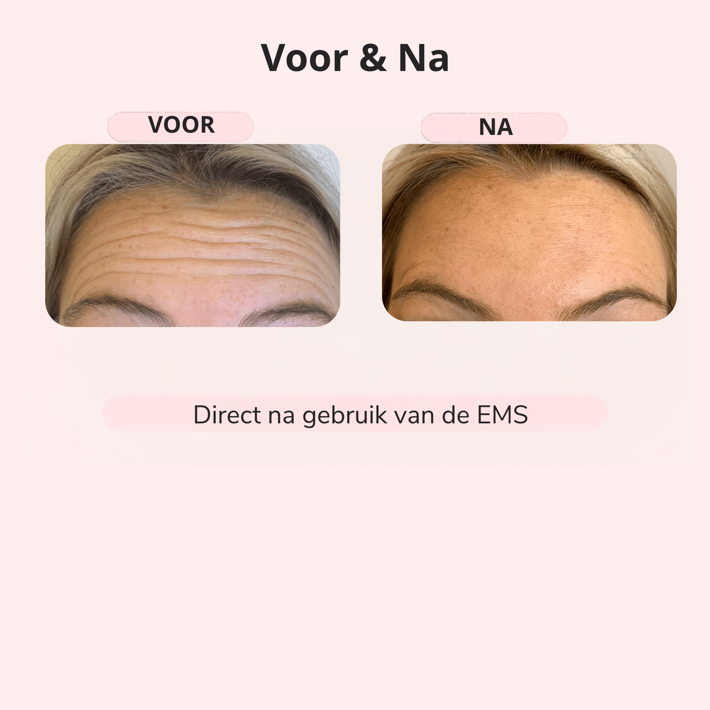 GlowLift™ – Strakkere Kaaklijn in 5 Min