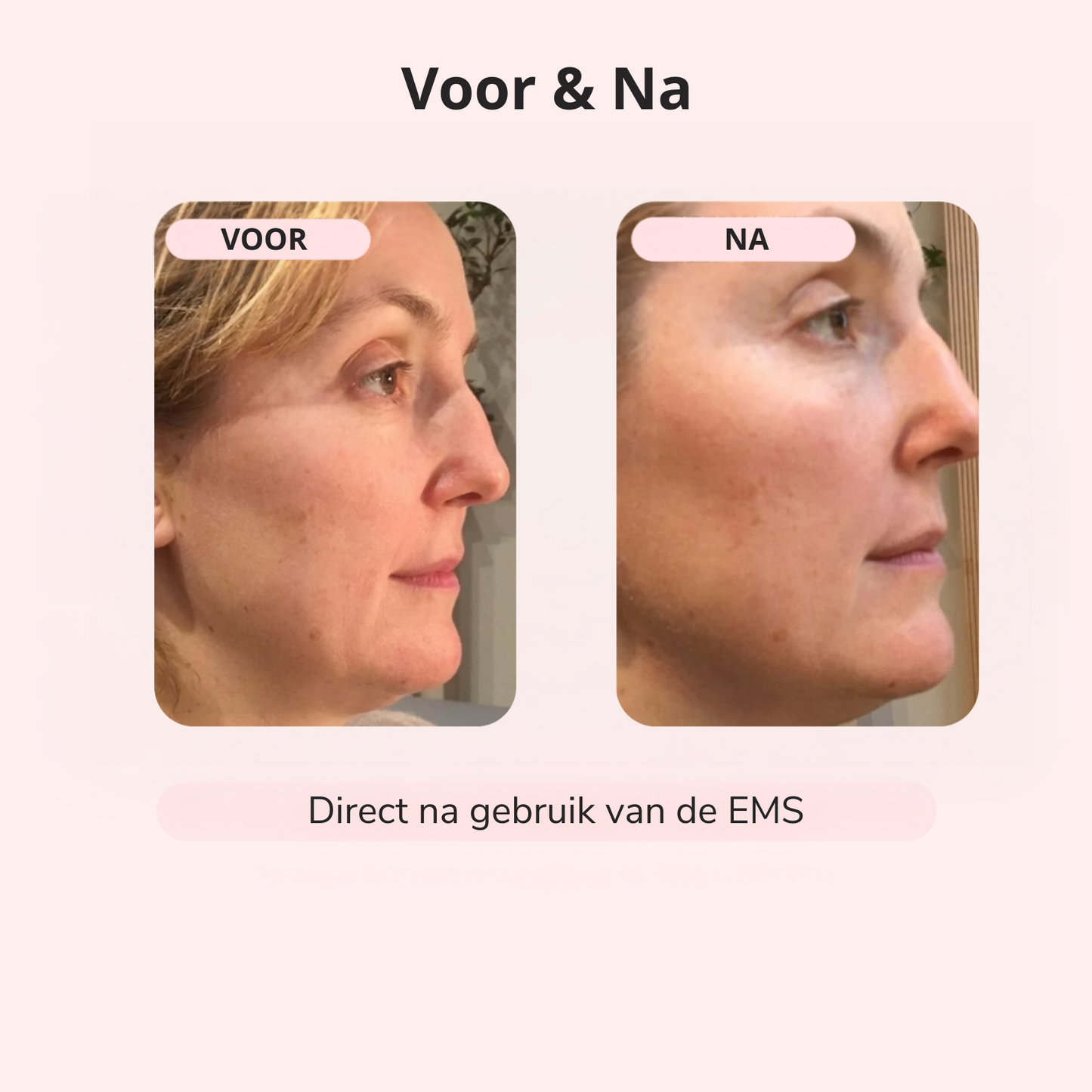 GlowLift™ – Strakkere Kaaklijn in 5 Min