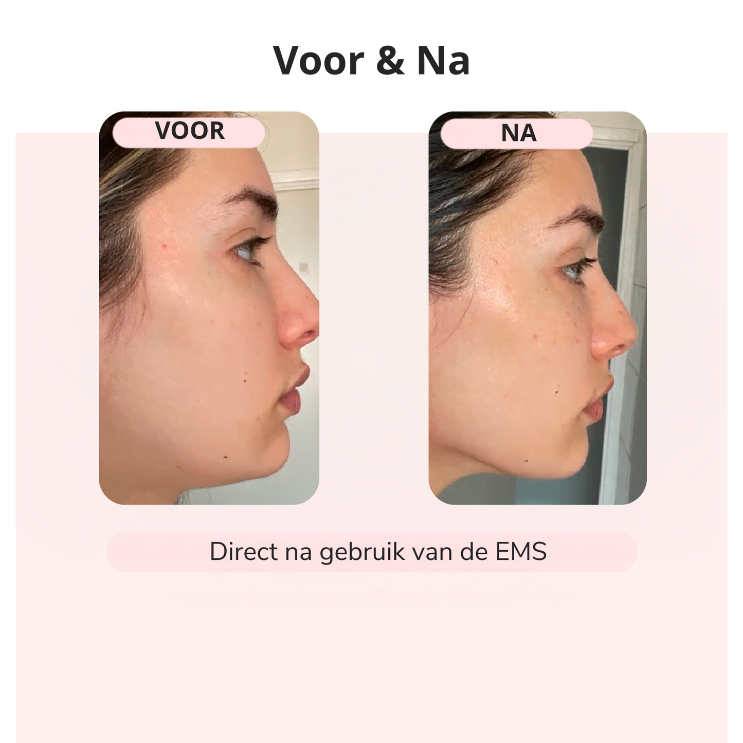 GlowLift™ – Strakkere Kaaklijn in 5 Min