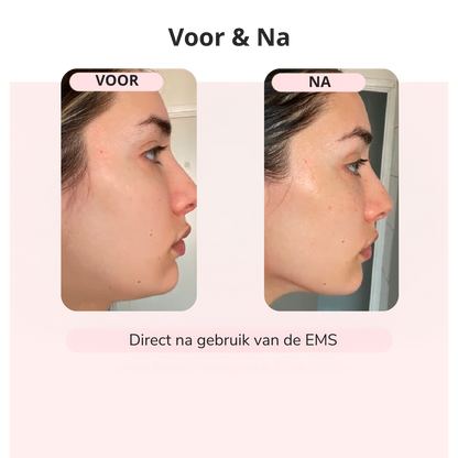 GlowLift™ – Strakkere Kaaklijn in 5 Min