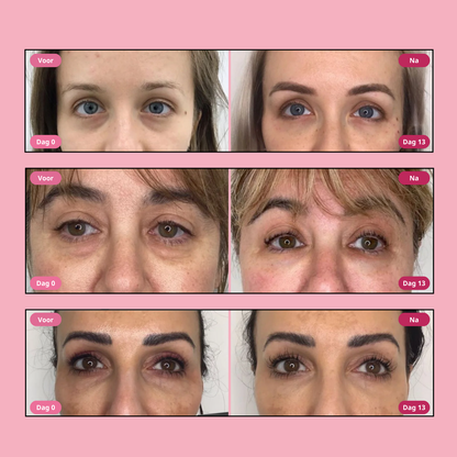 Hoygi Niacinamide & Green Tea Eye Serum - Vermindert zwarte kringen