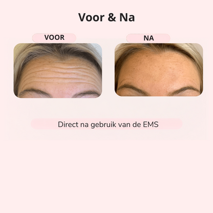 GlowLift™ – Strakkere Kaaklijn in 5 Min