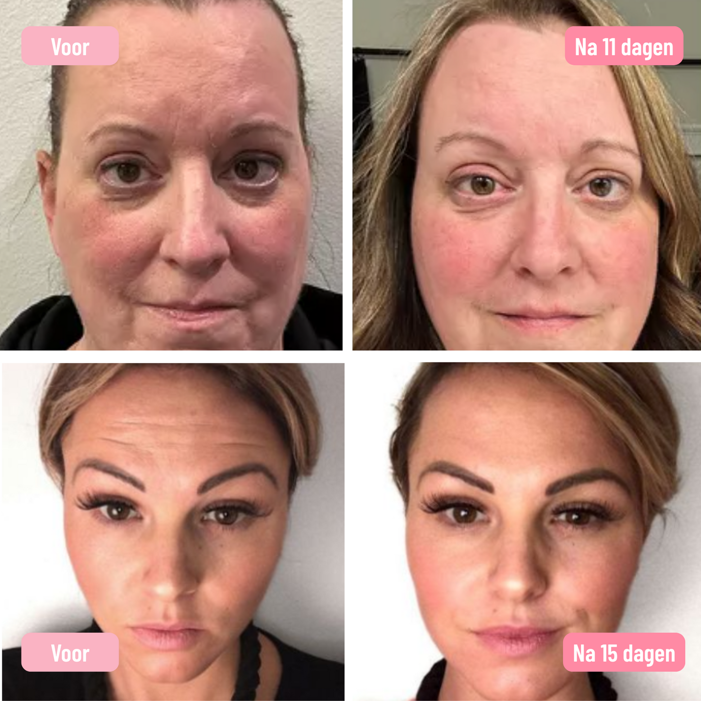 Ókady Anti-Rimpel Crème - 83 % minder rimpels