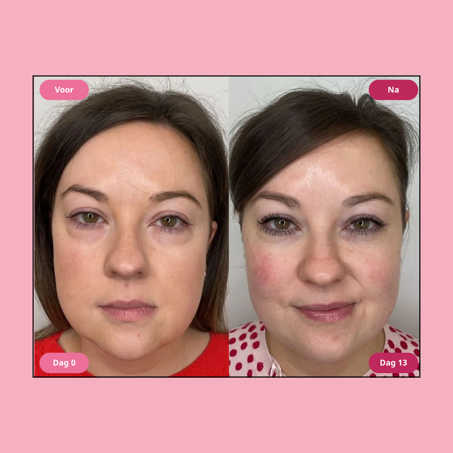 Hoygi Niacinamide & Green Tea Eye Serum - Vermindert zwarte kringen