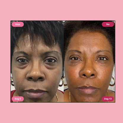 Hoygi Niacinamide & Green Tea Eye Serum - Vermindert zwarte kringen